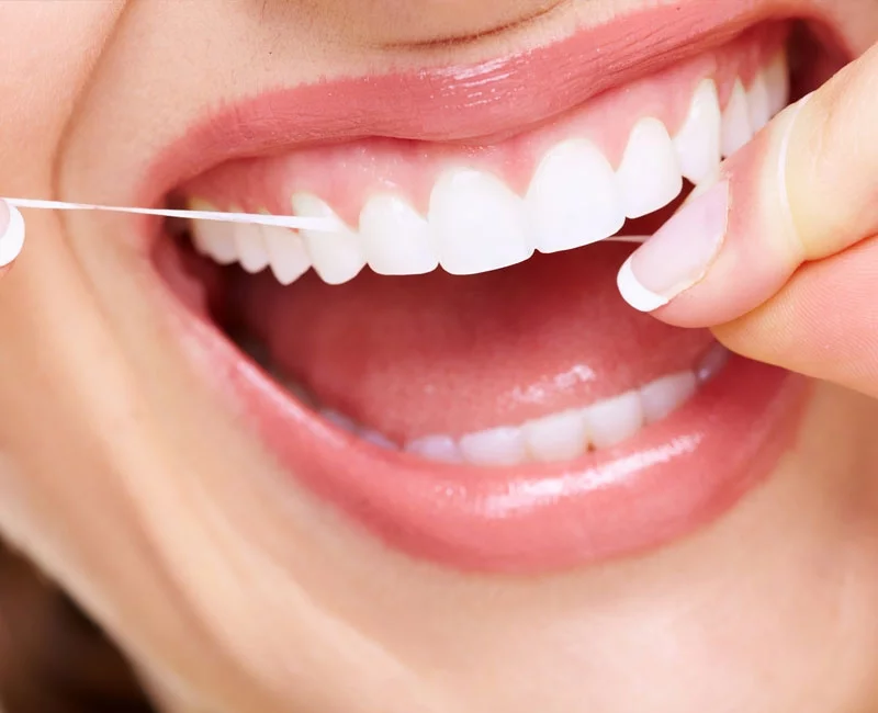 A professional dental cleaning in progress