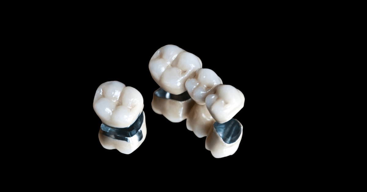 Dental crown illustration