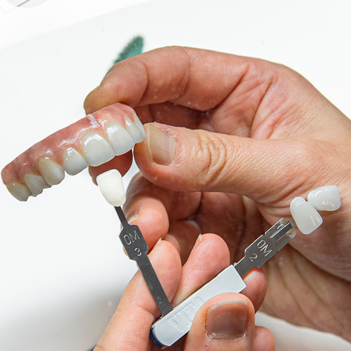 Dentist shade-matching a full arch restoration for a perfectly natural color